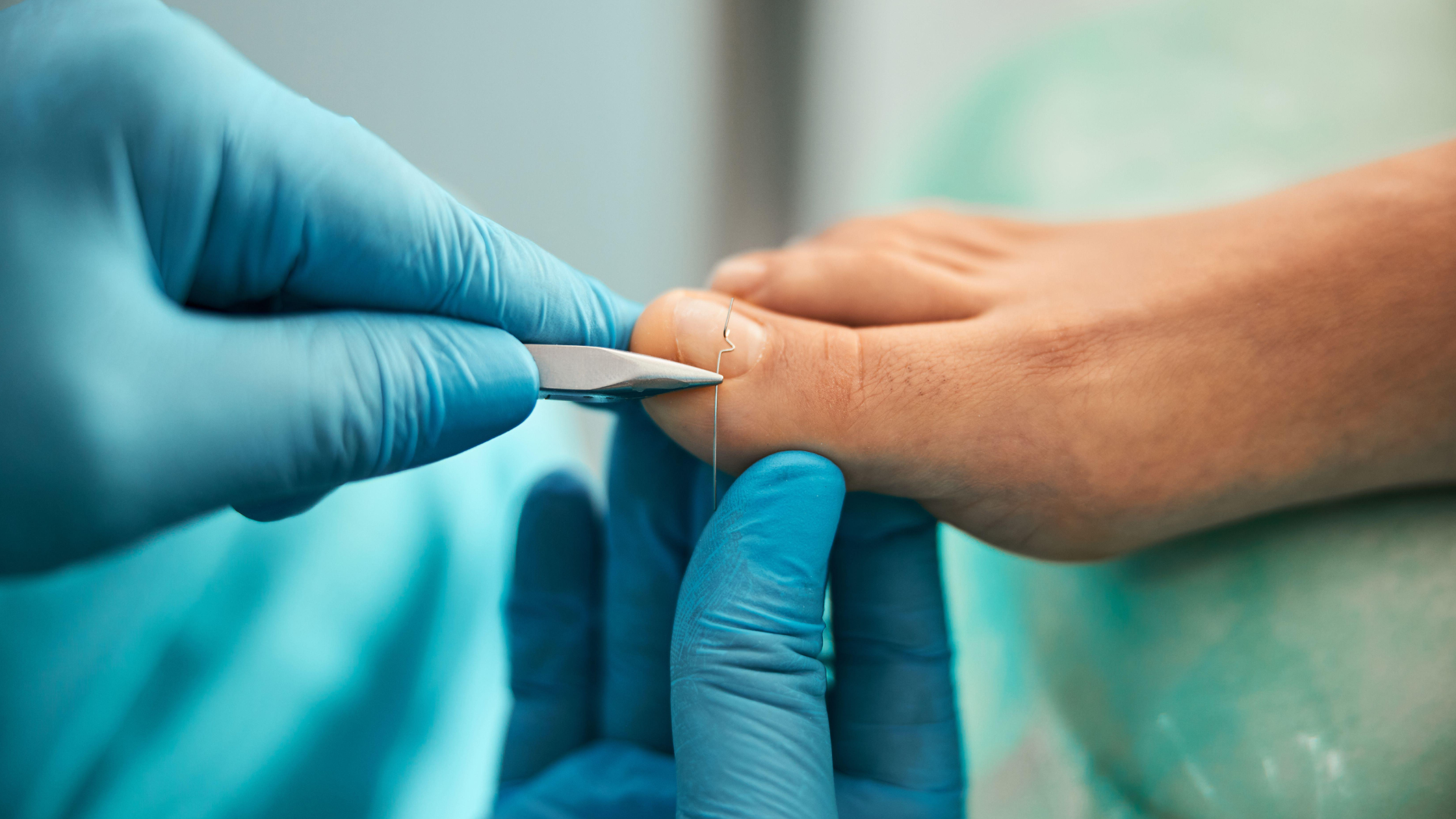 fungal nail treatment