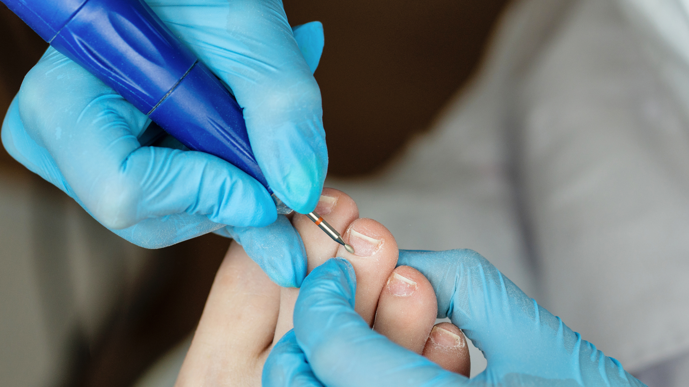 toenail surgery